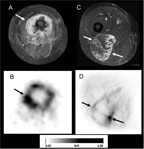 Theranostics Image