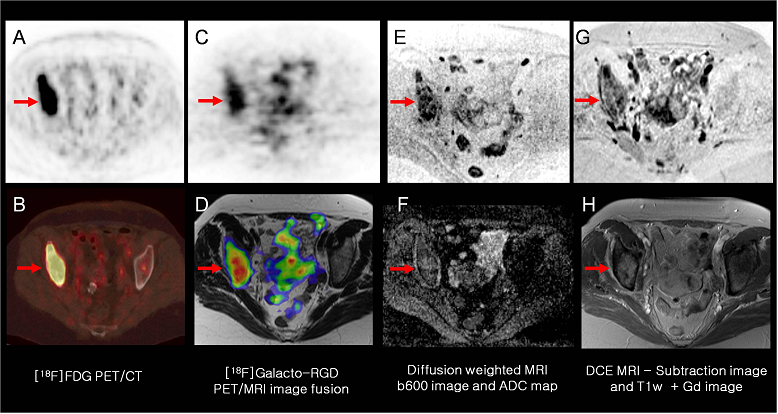 Theranostics Image