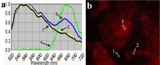 Theranostics Image