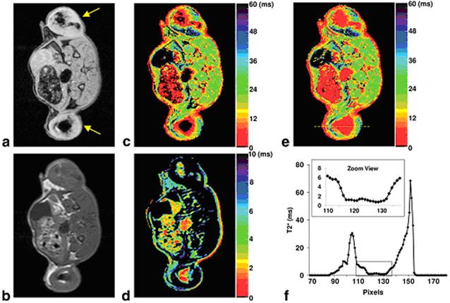 Theranostics Image