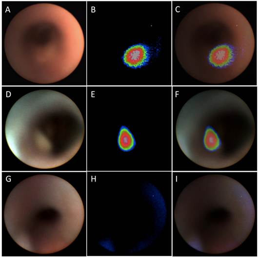 Theranostics Image