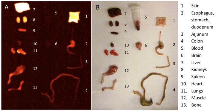 Theranostics Image