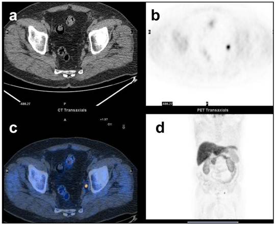 Theranostics Image