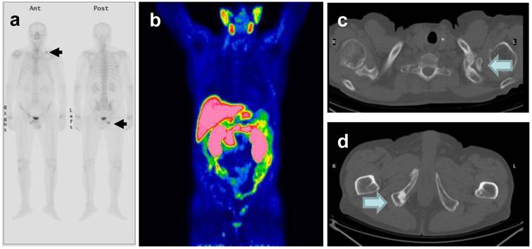 Theranostics Image