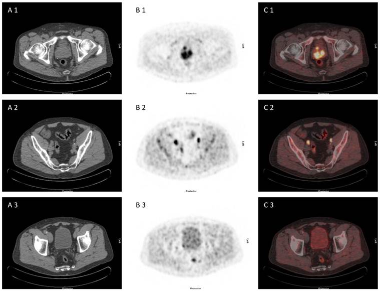 Theranostics Image