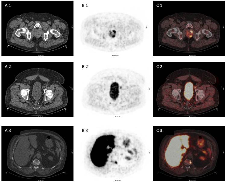 Theranostics Image