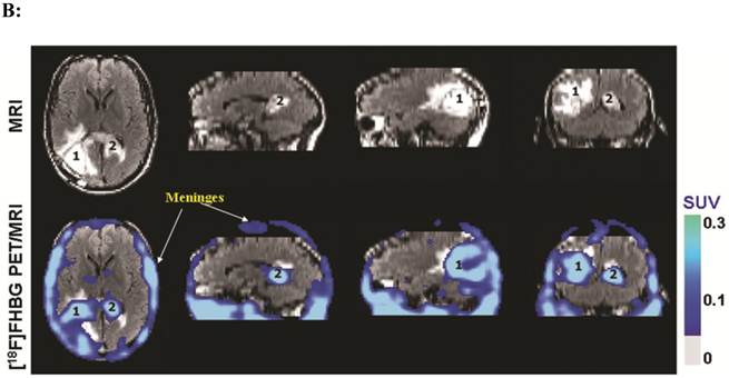 Theranostics Image