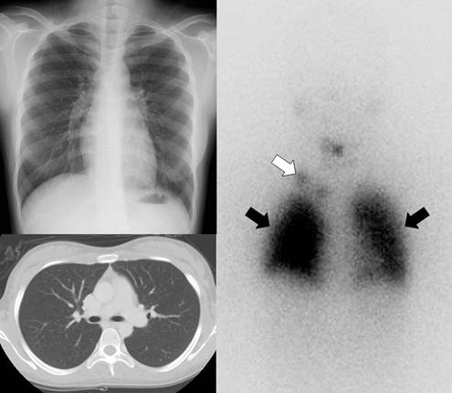 Theranostics Image