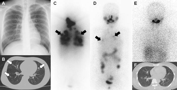 Theranostics Image