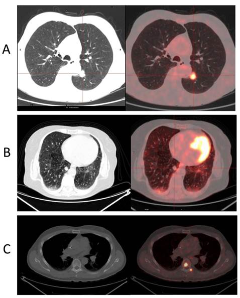 Theranostics Image