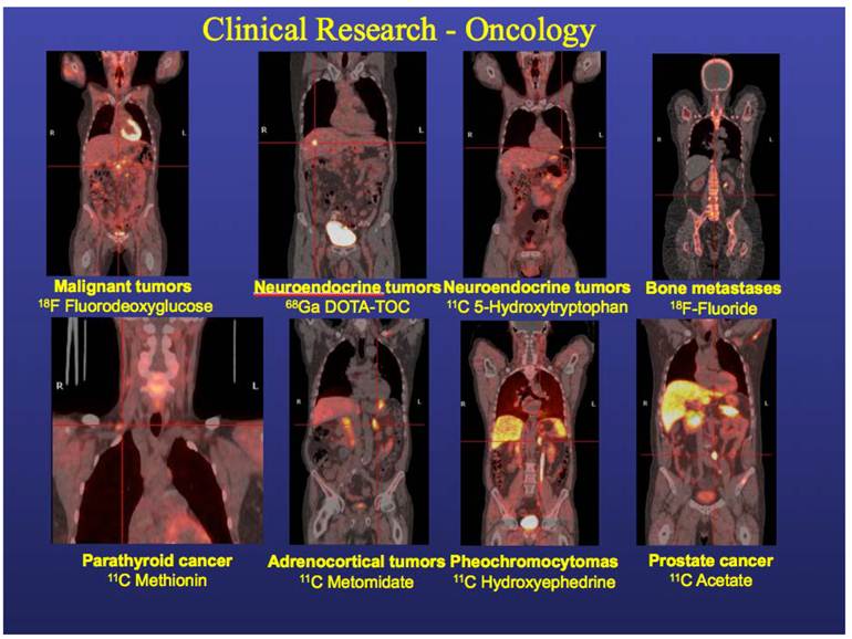 Theranostics Image