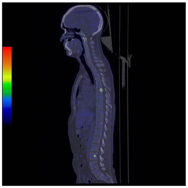 Theranostics Image