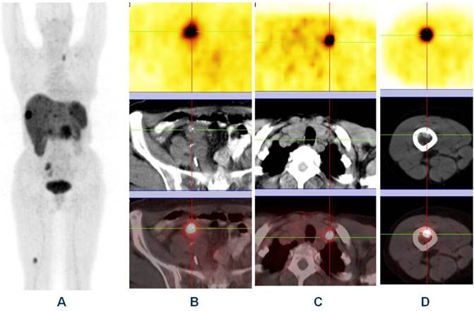 Theranostics Image