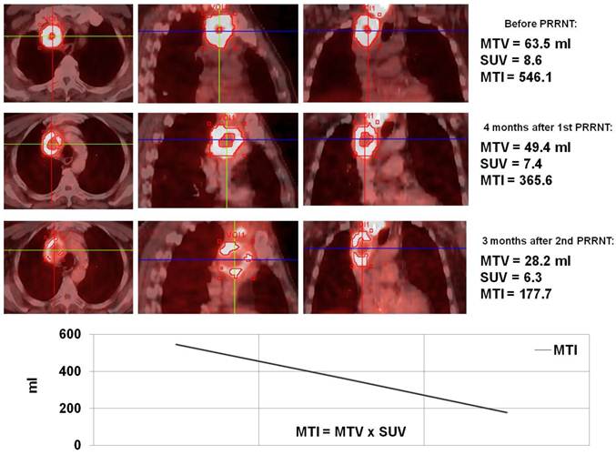 Theranostics Image