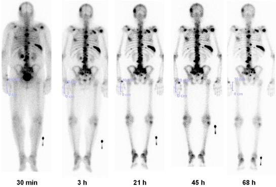 Theranostics Image