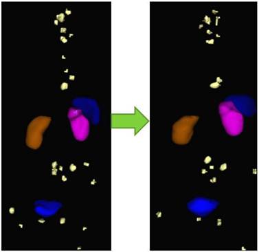 Theranostics Image