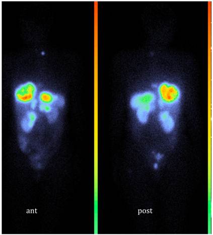 Theranostics Image