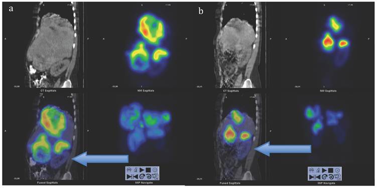 Theranostics Image