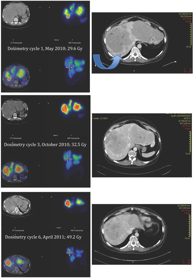 Theranostics Image