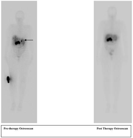 Theranostics Image