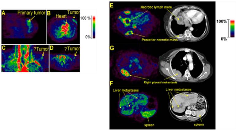 Theranostics Image