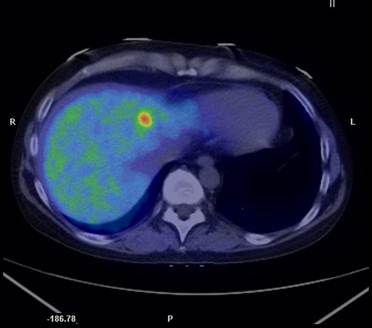 Theranostics Image