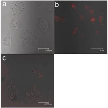 Theranostics Image