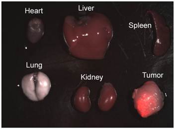 Theranostics Image