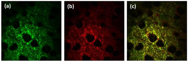 Theranostics Image