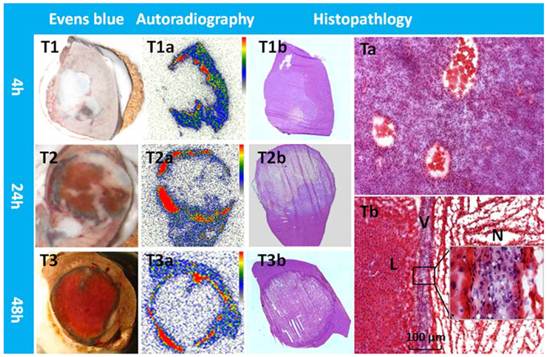 Theranostics Image