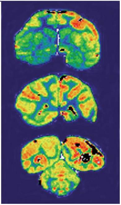 Theranostics Image