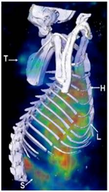 Theranostics Image