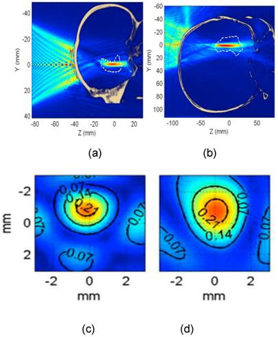 Theranostics Image