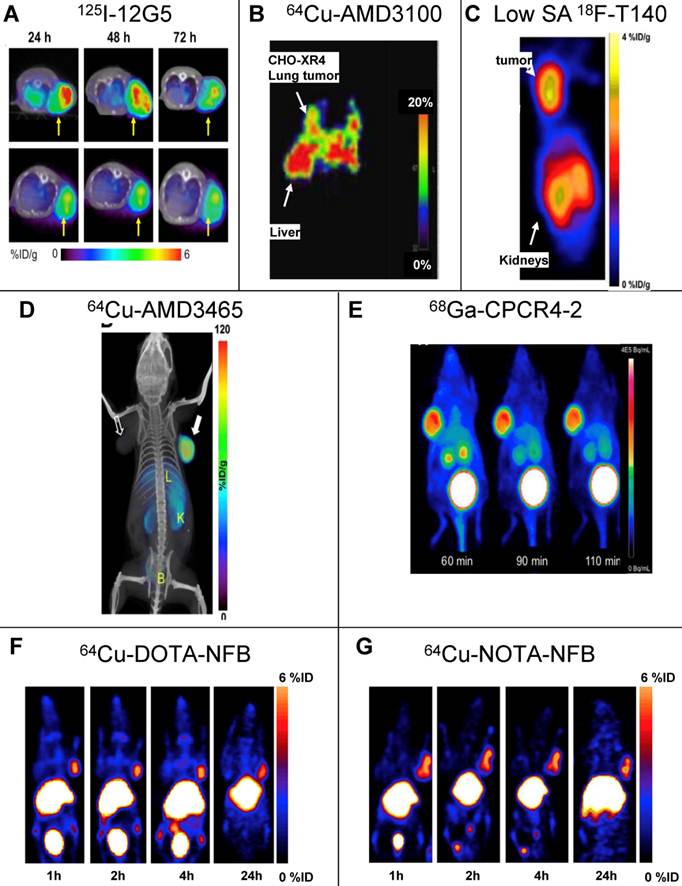 Theranostics Image