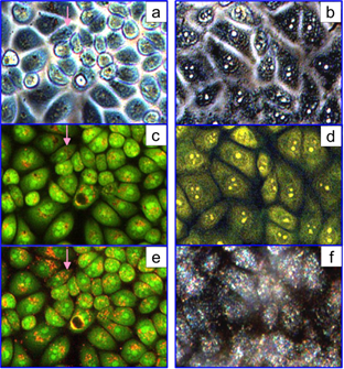 Theranostics Image