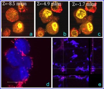 Theranostics Image