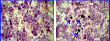 Theranostics Image