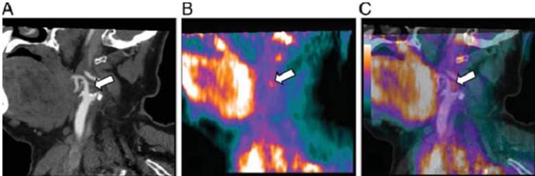 Theranostics Image