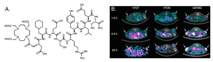 Theranostics Image