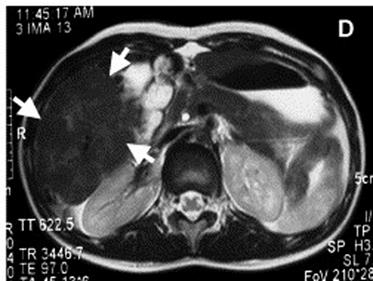 Theranostics Image