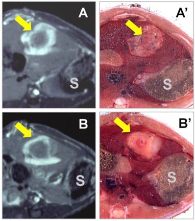 Theranostics Image