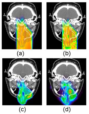 Theranostics Image