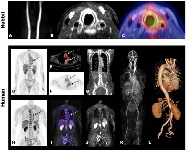 Theranostics Image