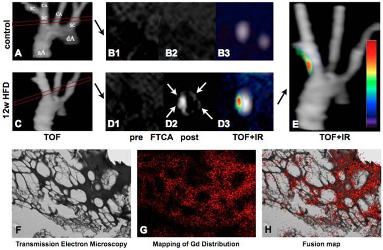 Theranostics Image