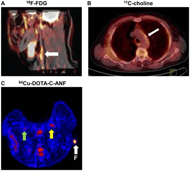 Theranostics Image