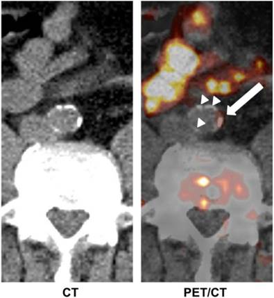 Theranostics Image