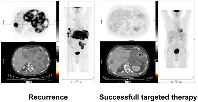 Theranostics Image