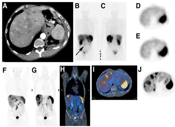 Theranostics Image