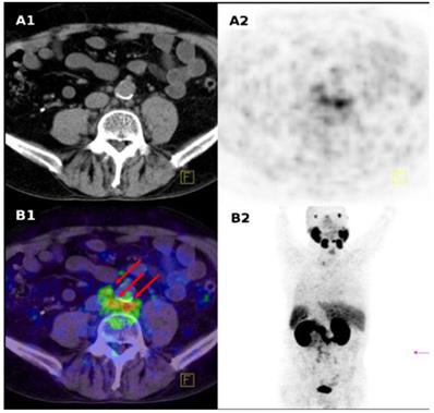 Theranostics Image