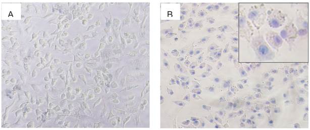 Theranostics Image